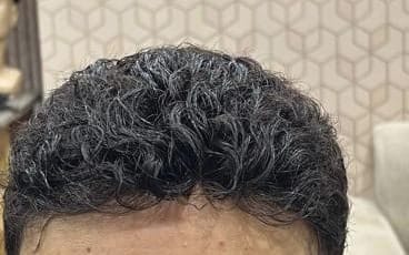 تفصيل مقرّب لملمس الشعر المموج وخط الشعر الأمامي من لوحة ٠٨ لعميل بعد تركيب نظام الشعر