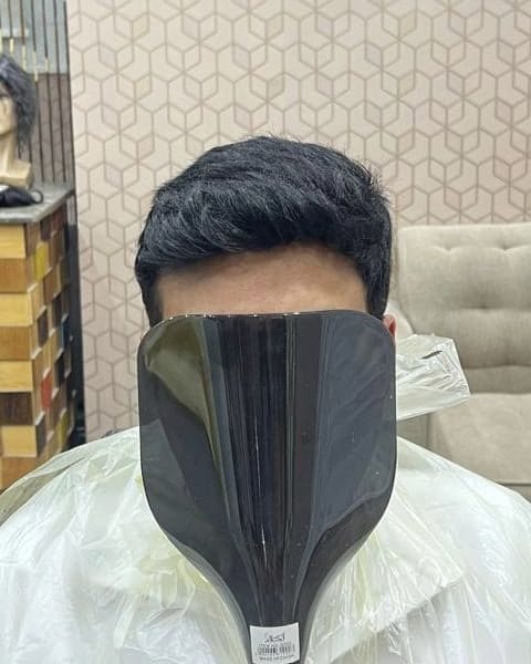شعر داكن كثيف بقصة كلاسيكية لعميل يرتدي ثوبًا أبيض بعد تركيب نظام الشعر في مركز الشام